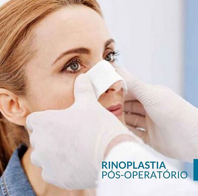 Rinoplastia – Pós Operatório