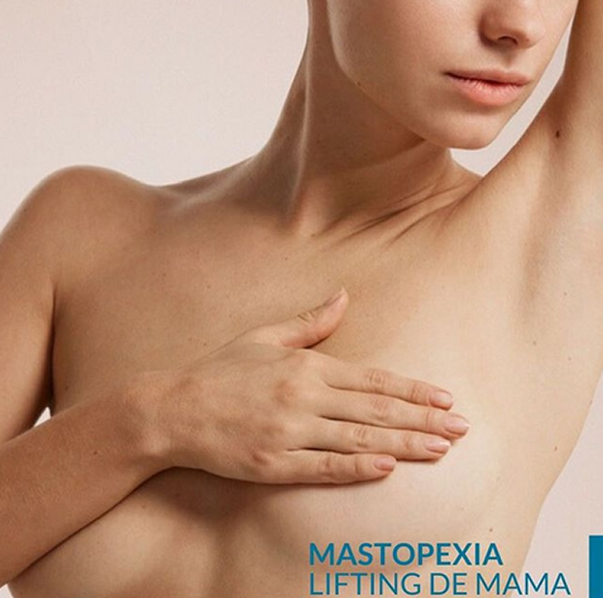 Mastopexia – Lifting de Mama