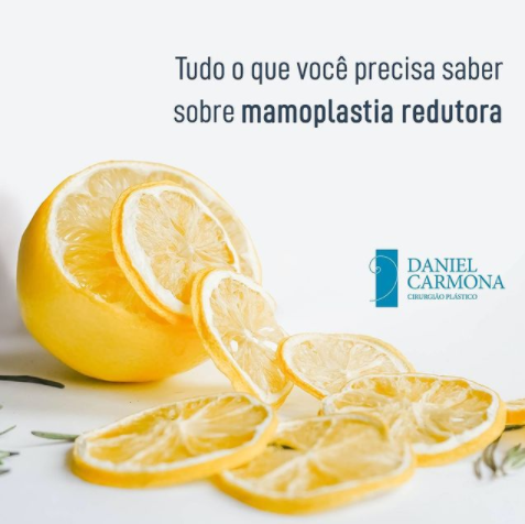 Tudo o que você precisa saber sobre mamoplastia redutora.