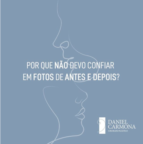 Por que não devo confiar em fotos de antes e depois?