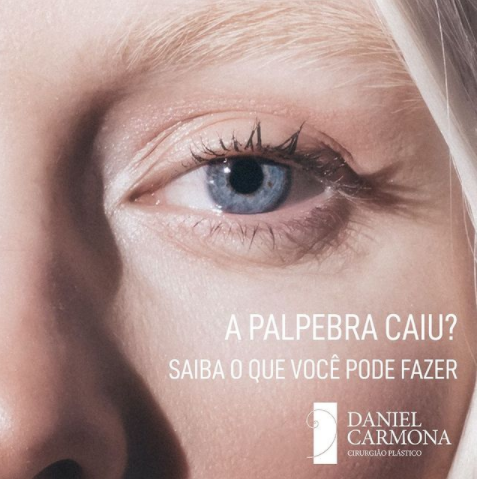 A pálpebra caiu? Saiba o que você pode fazer.