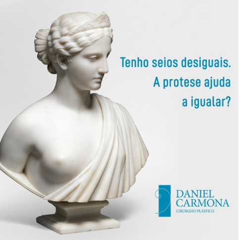 Tenho seios desiguais. A prótese ajuda a igualar?