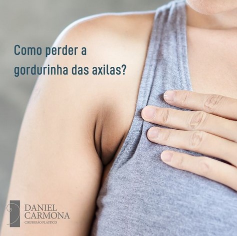 Gordurinhas nas axilas