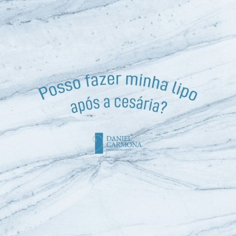 Posso fazer minha lipo após a cesária?