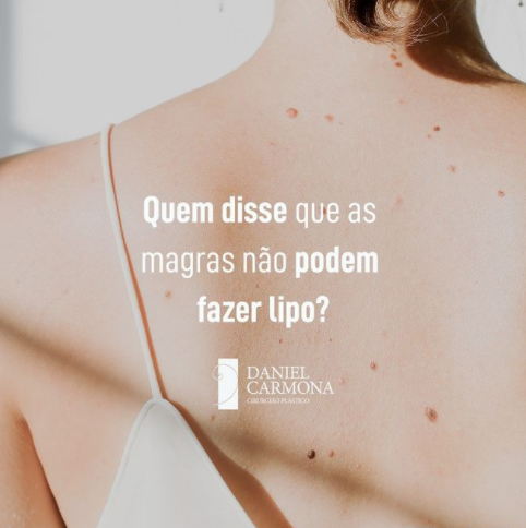 Quem disse que as magras não podem fazer lipo?