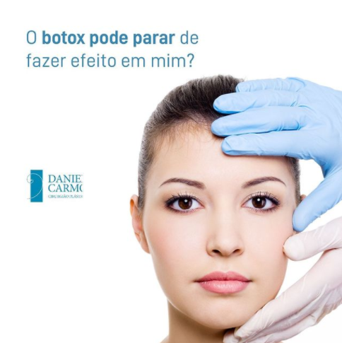 O Botox pode parar de fazer efeito em mim?