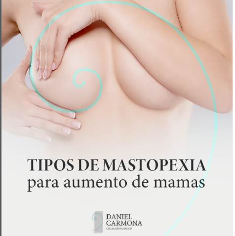 Tipos de Mastopexia para aumento de mamas