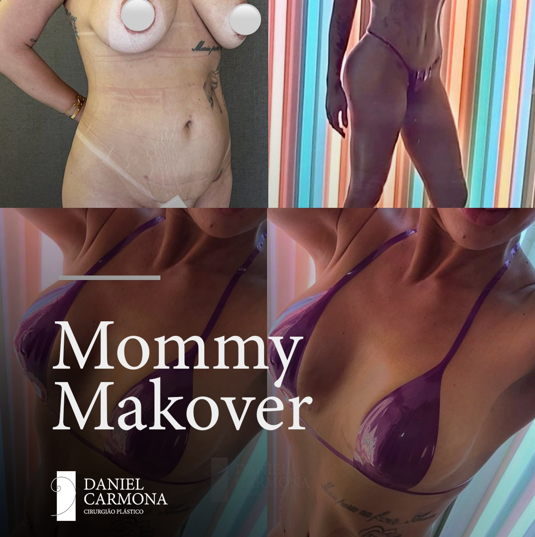 Mommy Makover